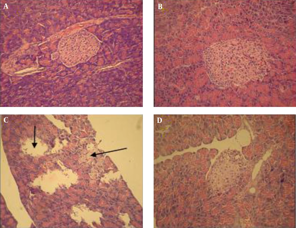 Histological Sections of the Pancreas from Different Studied Groups A, healthy controls; B, healthy controls treated with extract; C, untreated diabetic; D, diabetic treated with the extract. The arrows indicate the destruction of Langerhans islets in untreated diabetic group, but there were no histopathological changes in the other groups (H and E ×300).