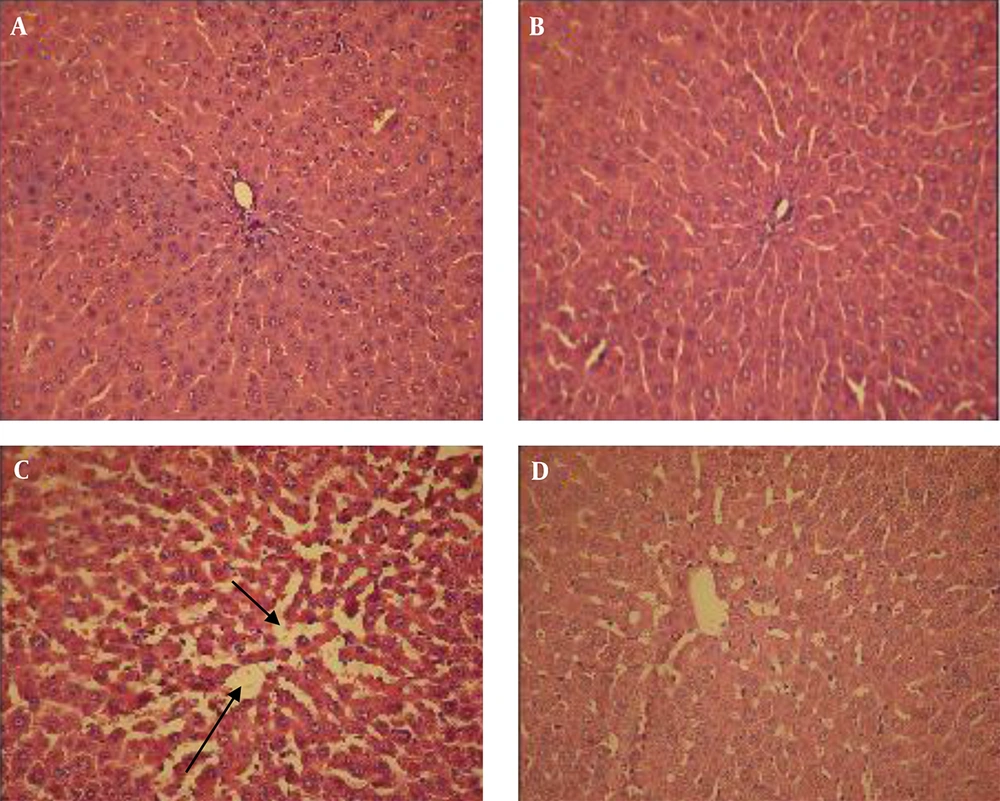 Histological Sections of Liver From Different Studied Groups A, healthy control; B, healthy control treated with extract; C, untreated diabetic; D, diabetic treated with extract. Liver of controls (untreated and treated with extract) shows no histopathological changes. The liver of an untreated diabetic shows a loss of cell arrangement and dilatation of the sinusoids (arrows), but liver in diabetics treated with hydro-alcoholic extract shows amelioration in the histological structure (H and E ×300).