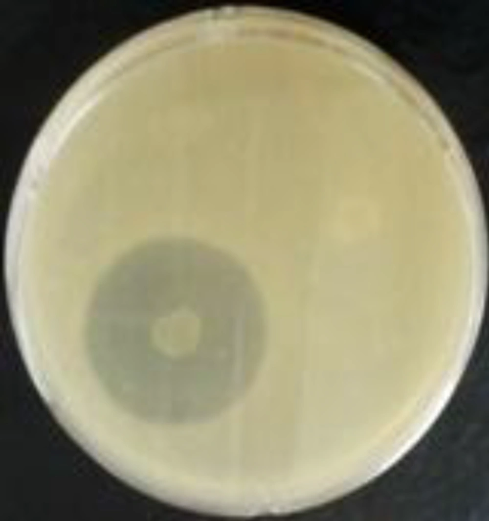 Chloroform-inactivated colonies of isolated endophytes showed antimicrobial activity against <i>S. aureus</i>. Chloroform-inactivated colonies of isolated endophytes showed antimicrobial activity against <i>S. aureus</i>.