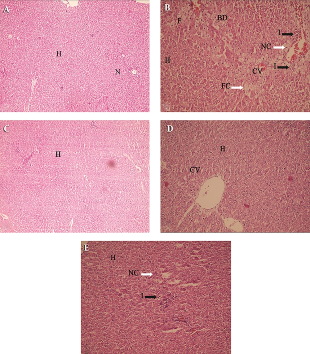 The Effect of the Bone Marrow Derived Mesenchymal Stem Cells (BM-MSCs) and Platelet Extract (PE) on the Histopathological Changes Induced by CCl<sub>4</sub> in Rats A: (H & E × 100) Liver section of normal rats showing normal hepatocytes with prominent nucleus, cytoplasm and central vein; (B) (H & E × 250) Liver sections of CCl<sub>4</sub> treated rats showing fatty chain, necrosis, infiltration of inflammatory cells; (C) (H & E × 250) Liver sections of the rats treated with MSC showing well brought out central vein hepatocytes with well-preserved cytoplasm (D) (H & E × 250); liver sections of the rats treated with PE showing well brought out normal hepatocytes with prominent nucleus (E) (H & E × 250); Liver sections of the rats treated with CCl<sub>4</sub> + PE showing well brought out central vein hepatocytes with well-preserved cytoplasm, slight necrosis and Inflammation (H - Hepatocyte, CV - Central vein, N - Nucleus , F-foamy macrophage cells, FC - Fatty Chain, NC - Necrosis ,I - infiltration of inflammatory cells, BD- ballooning degeneration). A: Control (0.5 mL/kg olive oil i.p.) B: CCl<sub>4</sub> (0.5 mL/kg i.p.) C: MSC (1 × 10<sup>6</sup> cell in 1 mL PBS infusion in liver) D: PE (0.5 mL/kg s.c.) E: CCl<sub>4</sub> + PE (0.5 mL/kg i.p + 0.5 mL/kg s.c.)