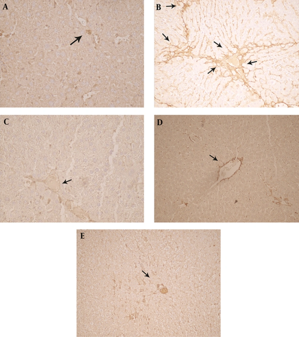 The Expression and Specific Tissue Distribution of α-SMA in Rat Livers (A) In the livers of control animals, α-SMA immunopositivity was restricted to smooth musculature (arrow), while other liver cells remained negative (B). In mice receiving CCl<sub>4</sub> twice a week for eight weeks (0.5 mL/kgi.p. 1:1 in olive oil), many α-SMA containing myofibroblasts were strongly and diffusely stained in affected lobuli (arrows). (C) In the MSC + CCl<sub>4</sub> group four weeks after the first injection, MSC was infused to their liver lobs locally and then injection of CCl<sub>4</sub> was continued for eight weeks, clusters of moderately α-SMA immunopositive hepatocytes (arrows) (D). The rat livers received (0.5 mL/kg s.c.) PE (E). The rat livers receiving liver sections of the rats treated with CCl<sub>4</sub> + PE (0.5 mL /kg i.p + 0.5 mL /kg s.c.) showed normal architecture of hepatocytes and mild infiltration of inflammatory cells. Original magnification 250 × immunohistochemical stain for α-SMA.