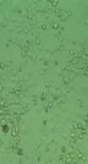 Comparison of the In Vitro Antifibrogenic Effects of Silymarin, Silybin A and 18α-Glycyrrhizin on Activated Hepatic Stellate Cells