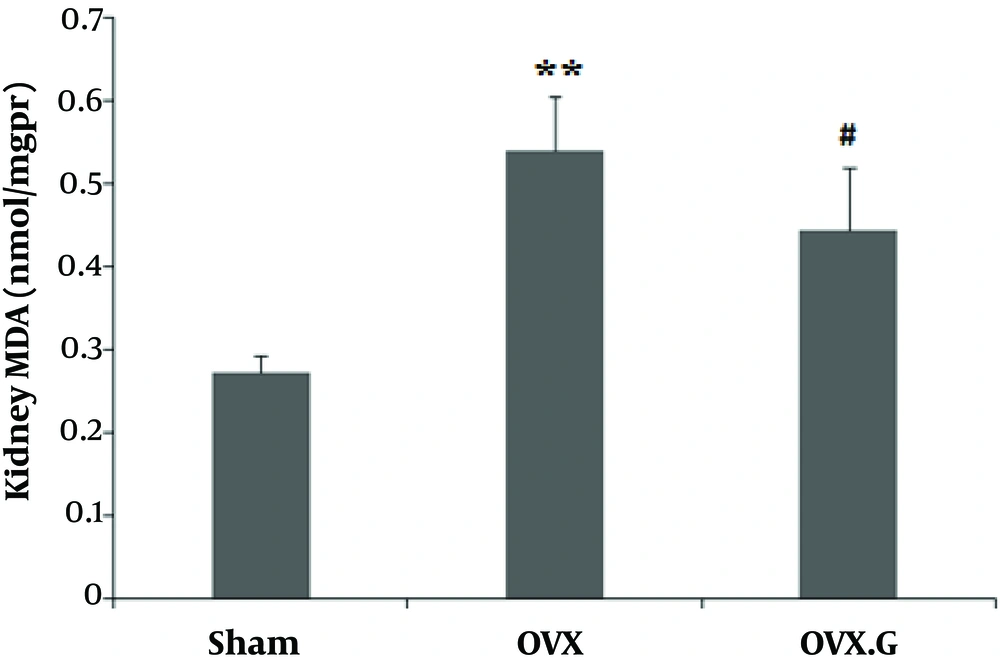 Effect of genistein on MDA level in the kidney of ovariectomized rats. The values represent means ± SEM (n = 10). **P < 0.01 versus sham group. #P < 0.05 versus OVX group. Effect of genistein on MDA level in the kidney of ovariectomized rats. The values represent means ± SEM (n = 10). **P < 0.01 versus sham group. #P < 0.05 versus OVX group.