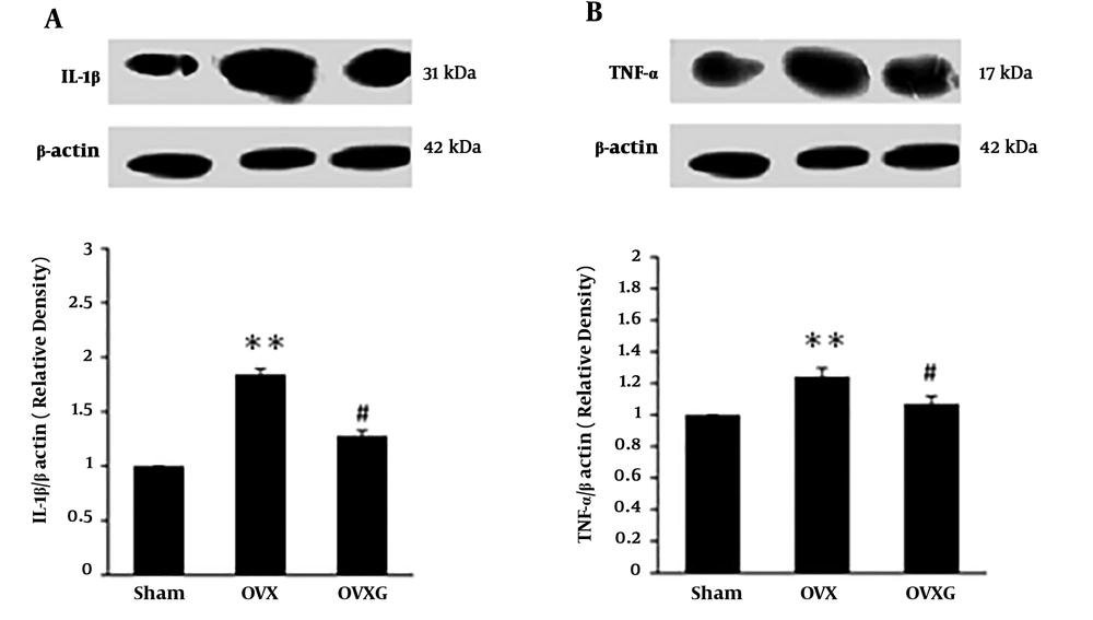 Effect of genistein on TNF-α and IL-1β expression in the kidney of ovariectomized rats. The values represent means ± SEM (n = 10). **P < 0.01 versus sham group. #P < 0.05 versus OVX group. Effect of genistein on TNF-α and IL-1β expression in the kidney of ovariectomized rats. The values represent means ± SEM (n = 10). **P < 0.01 versus sham group. #P < 0.05 versus OVX group.