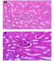 Protective Effects of Micro-Emulsion of Sour Cherry (Prunus cerasus L.) Kernel Extract on Methimazole-Induced Nephrotoxicity in Mice