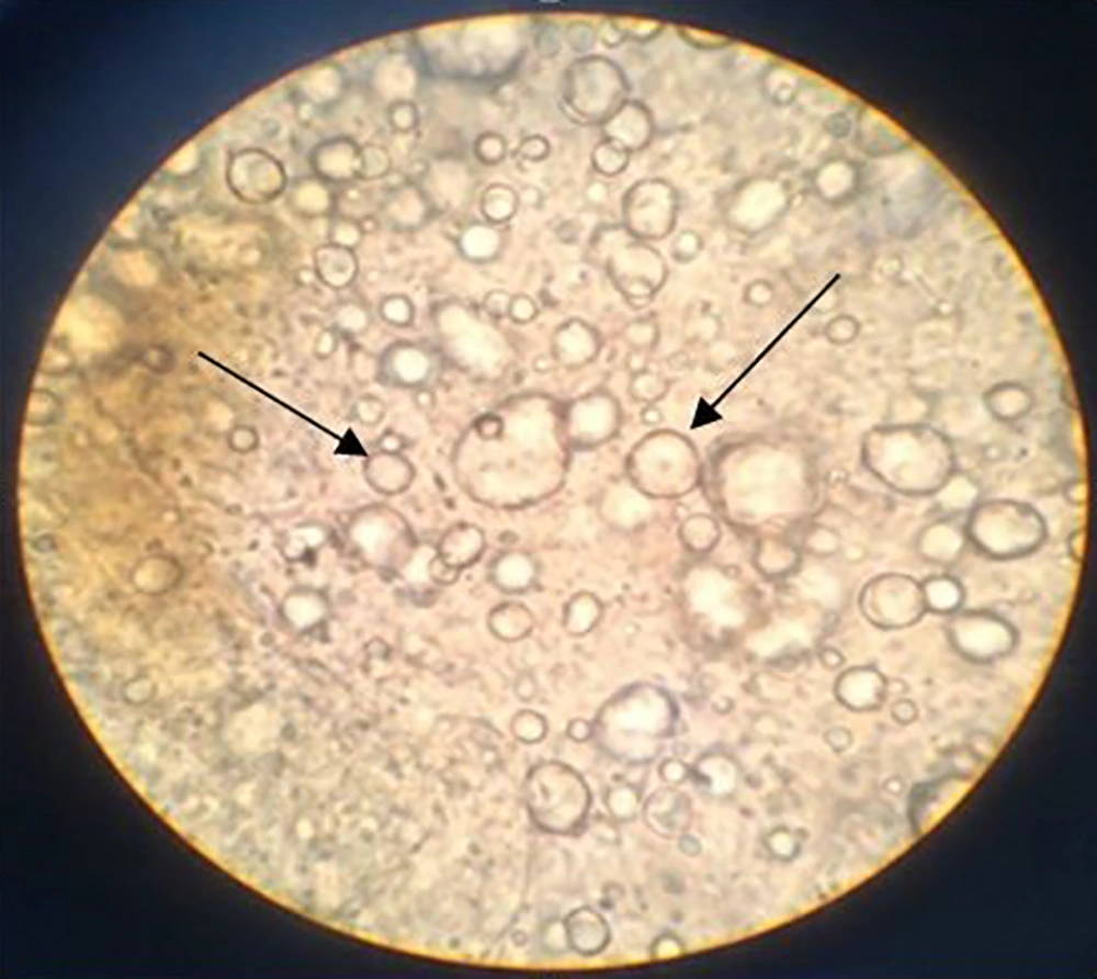 The microscopic image of the emulsion shows the dispersion of oil droplets (arrows) in water The microscopic image of the emulsion shows the dispersion of oil droplets (arrows) in water