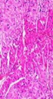 The Evaluation of the Ameliorative Effect of Montelukast Against Arsenic Trioxide-Induced Cardiotoxicity in Rats