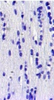Withania coagulans Protects Striatum from Oxidative Damages Induced by Global Brain Ischemia in Rat