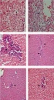 Circulating miR-122 and miR-192 as Specific and Sensitive Biomarkers for Drug-Induced Liver Injury with Acetaminophen in Rats