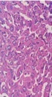 Berberine Attenuated Oxidative Stress Induced by Sodium Nitrite in Rat Liver