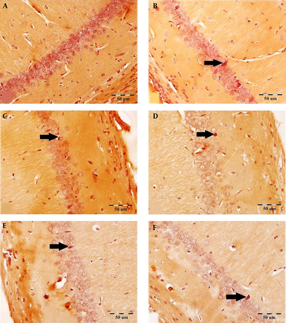 The effect of <i>Ginkgo biloba</i> extract on the scopolamine-induced congophilic amyloid plaque accumulation in the CA1 region. The brain sections were stained with Congo red for amyloid β plaque. Arrows demarcate the amyloid β plaque in the CA1 region in all groups. A: Control, B: Sham-scopolamine, C: Treatment group, treated with scopolamine and 40 mg/kg/day <i>Ginkgo biloba</i> extract, D: Treatment group, treated with scopolamine and 80 mg/kg/day <i>Ginkgo biloba</i> extract, E: Pretreatment group, treated with 40 mg/kg/day <i>Ginkgo biloba</i> extract and scopolamine, F: Pretreatment group, treated with 80 mg/kg/day <i>Ginkgo biloba</i> extract and scopolamine. The effect of <i>Ginkgo biloba</i> extract on the scopolamine-induced congophilic amyloid plaque accumulation in the CA1 region. The brain sections were stained with Congo red for amyloid β plaque. Arrows demarcate the amyloid β plaque in the CA1 region in all groups. A: Control, B: Sham-scopolamine, C: Treatment group, treated with scopolamine and 40 mg/kg/day <i>Ginkgo biloba</i> extract, D: Treatment group, treated with scopolamine and 80 mg/kg/day <i>Ginkgo biloba</i> extract, E: Pretreatment group, treated with 40 mg/kg/day <i>Ginkgo biloba</i> extract and scopolamine, F: Pretreatment group, treated with 80 mg/kg/day <i>Ginkgo biloba</i> extract and scopolamine.