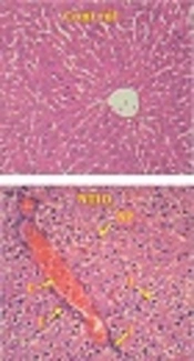 Quercetin Effects on Hepatotoxicity Induced by Titanium Dioxide Nanoparticles in Rats