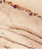 Evaluation of the Apoptotic and Scolicidal Effects of Crude and Flavonoid Extracts of Allium noeanum on Protoscolices and Hydatid Cyst Wall