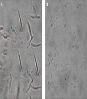 Cover image of the article: Apoptosis-Like Cell Death in Leishmania major Treated with HESA-A: An Herbal Marine Compound