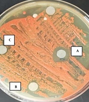 Effects of Tamoxifen as an Antifungal Agent against Oral Cavity Yeasts In-Vitro and in Breast Cancer Patients