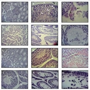 Reduction of Bisphenol A-induced Male Reproductive Toxicity by Bromelain in Mice