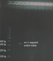 Cover image of the article: Evaluation of Plasmid Mediated Colistin Resistance in Colistin Resistant Gram-negative Bacilli