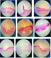 Evaluating the Effect of Argon and Helium Atmospheric Cold Plasma Jets on Wound Healing in Rats: A Comparative Histopathological and Biochemical Analysis