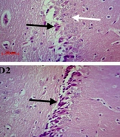 Long-term Administration of High-Dose Methylphenidate Impairs Spatial Memory and Induces Neurodegeneration in the Hippocampus