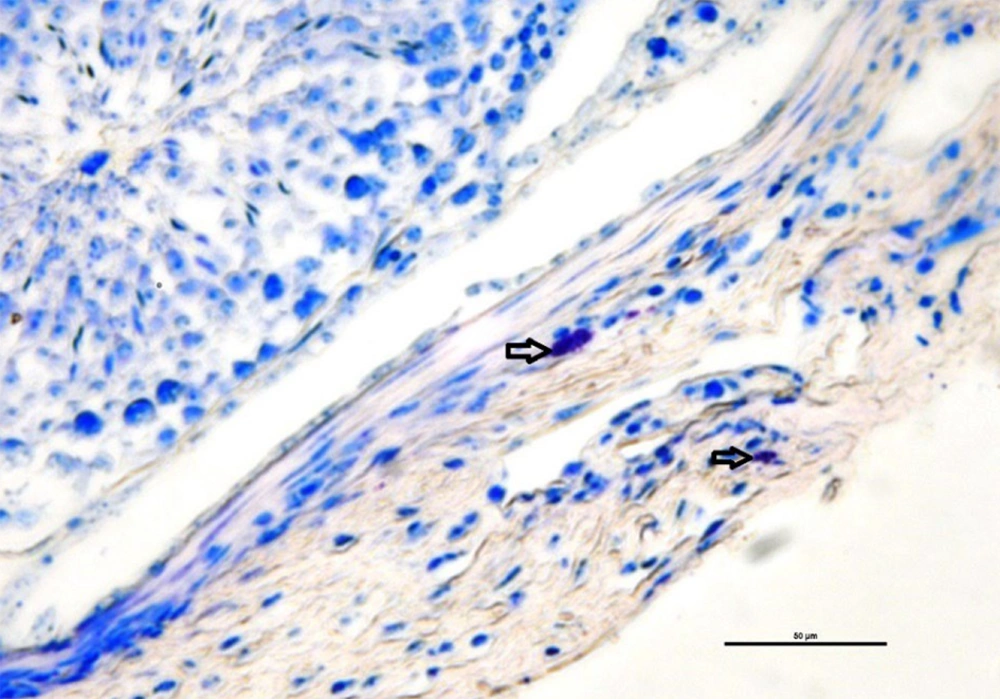 Mast cells in the testicular capsule (arrows). They have a large number of reddish-purple granules in their cytoplasm. Toluidine blue staining method. Mast cells in the testicular capsule (arrows). They have a large number of reddish-purple granules in their cytoplasm. Toluidine blue staining method.
