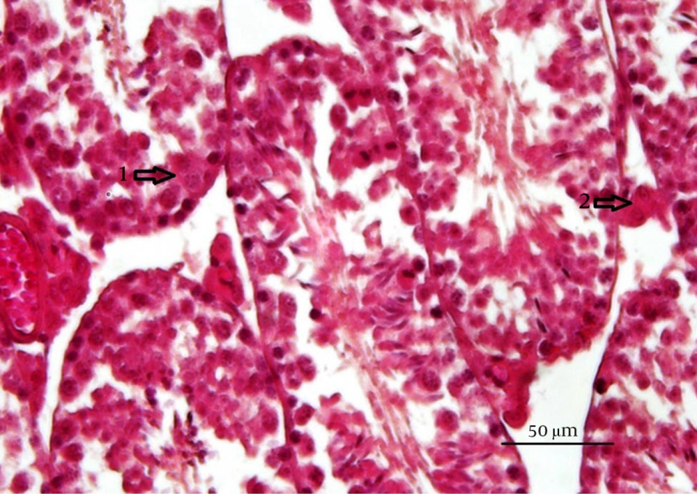 Periodic acid-Schiff (PAS) reaction in the cytoplasm of the (1) spermatogenic cells and (2) leydig cells for detecting the carbohydrate, including foci (PAS staining method). Periodic acid-Schiff (PAS) reaction in the cytoplasm of the (1) spermatogenic cells and (2) leydig cells for detecting the carbohydrate, including foci (PAS staining method).