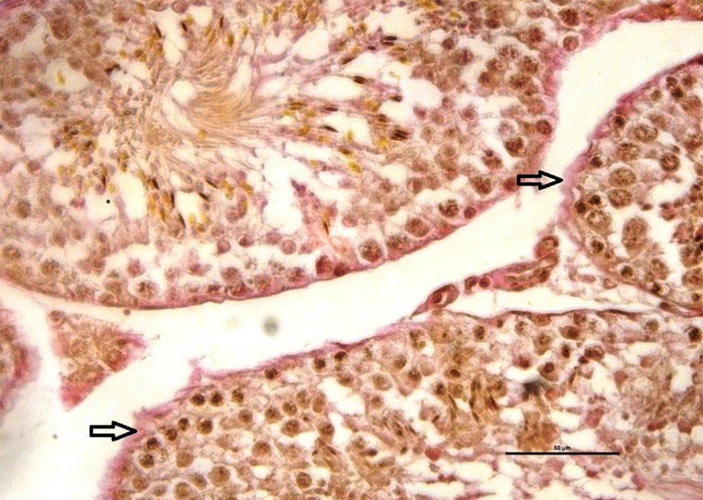 Collagen fibers in red (arrows) are indicated around the seminiferous tubules (Van Geisson staining method). Collagen fibers in red (arrows) are indicated around the seminiferous tubules (Van Geisson staining method).