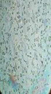 Genotoxicity and Cytotoxicity Assessment of Graphene Oxide Nanosheets on HT29 Cells