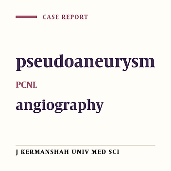 Superselective Embolization of Pseudoaneurysm Following Percutaneous Nephrolithotomy (PCNL)- A Case Reort