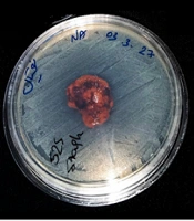Evaluating the Antibacterial Properties of a Zeolite-Chitosan Biocomposite for Medical Applications
