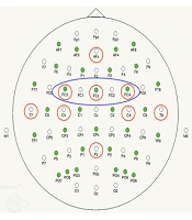 Effects of Single-Session Practice Structure on Motor Skill Acquisition and Alpha and Beta EEG Oscillations