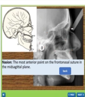 Using Edutainments in Teaching Orthodontic Lateral Cephalometric and Dental Cast Analysis