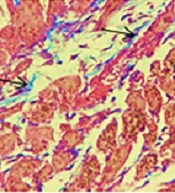 Cover image of the article: Cardioprotective Effect of Hydroalcoholic Extract of Lepidium draba on Isoproterenol-Induced Acute Myocardial Infarction in Rats