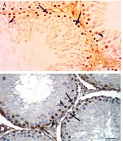 Examination of the Toxicity Pattern and Influence of Azadirachta indica on Testicular Function and Expression of Proliferating Cell Nuclear Antigen in Plasmodium berghei-Infected Mice
