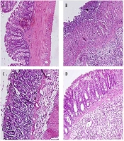 Effects of Methanol Extract from the Peel of Red Onion (Allium cepa L.) on Ulcerative Colitis Induced by Acetic Acid in Wistar Rats