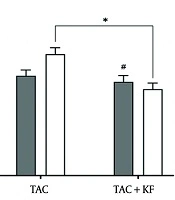 Exploring Kaempferol's Potential Immunomodulation and Alleviation of Tacrolimus-Induced Hyperglycemia