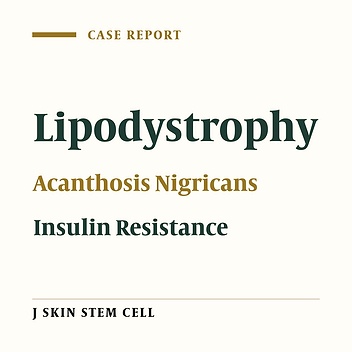 A Case With Lipodystrophy, Acanthosis Nigricans and Insulin Resistance
