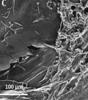 A Novel Composite Nano-scaffold with Potential Usage as Skin Dermo-epidermal Grafts for Chronic Wound Treatment