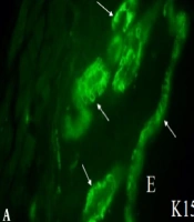 Elastin is Related to Functions of Melanocytes in Normal and Abnormal Skin