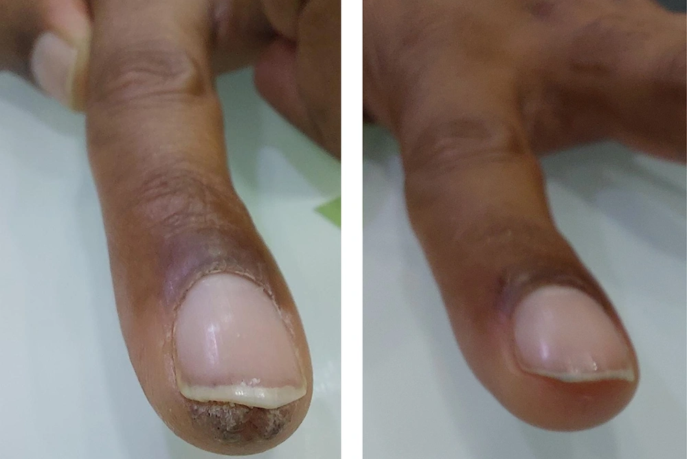 Before and After Before and After