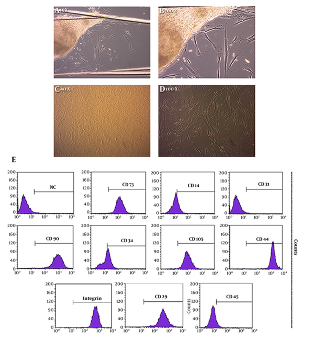 Isolated Human Newborn Foreskin Cells from Circumcised Waste Tissue. A and B, Primary Cell Culture Image Provided by Explant Culture Technique with Different Magnifications; C and D, Continuous Cell Culture Images of hnFSSCs at Passage 3; E, Characterization of Stem Cell Properties of the Human Newborn Foreskin Cells. Cells Cultured at Passage 3 Were Examined. Major Population of Cells Preserved the Characteristics of Stem Cells. Flow Cytometry Analysis Data Illustrated the Positivity for Both Hematopoietic and Mesenchymal Stem Cell Surface Markers Except from the Endothelial Marker CD31. NC, Negative Control Isolated Human Newborn Foreskin Cells from Circumcised Waste Tissue. A and B, Primary Cell Culture Image Provided by Explant Culture Technique with Different Magnifications; C and D, Continuous Cell Culture Images of hnFSSCs at Passage 3; E, Characterization of Stem Cell Properties of the Human Newborn Foreskin Cells. Cells Cultured at Passage 3 Were Examined. Major Population of Cells Preserved the Characteristics of Stem Cells. Flow Cytometry Analysis Data Illustrated the Positivity for Both Hematopoietic and Mesenchymal Stem Cell Surface Markers Except from the Endothelial Marker CD31. NC, Negative Control