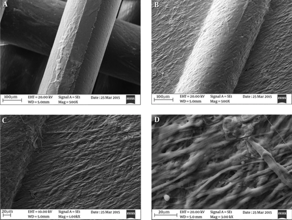 PCL-based Nanofibers and the Seeding of Human Newborn Foreskin Stem Cells. Human Newborn Foreskin Cells (A) and the Differentiated Cells (B - D) Were Both Apparently Attached To Nanofiber Substrates. PCL Nanofibers Were Still Visible at 24 Days Following the Seeding of Human Newborn Foreskin Stem Cells PCL-based Nanofibers and the Seeding of Human Newborn Foreskin Stem Cells. Human Newborn Foreskin Cells (A) and the Differentiated Cells (B - D) Were Both Apparently Attached To Nanofiber Substrates. PCL Nanofibers Were Still Visible at 24 Days Following the Seeding of Human Newborn Foreskin Stem Cells