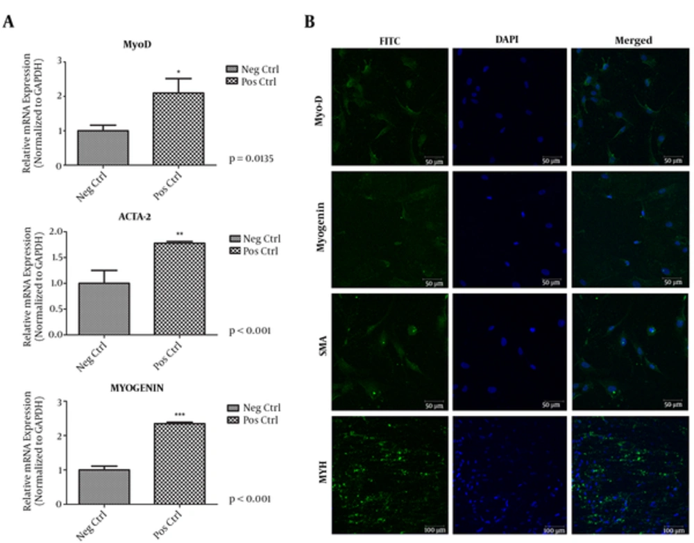 A, Quantification of Cells Expressing Muscle-Specific Markers Regarding to the Quantitative Real Time PCR Results. MyoD; Myoblast Determination Gene, Myogenin, ACTA2; Alpha-Actin- 2 Gene, GAPDH Glyceraldehyde3-Phosphatedehydrogenase, qPCR Quantitative Real-Time Polymerase Chain Reaction; *P < 0.05 Stands for DF Versus NC; B, Mesoderm Derived Myogenic Differentiation of Human Newborn Foreskin Cells. SMA; Smooth Mucle Actin, MYH; Myosin Heavy Chain. Immunocytochemistry Results Demonstrate Positive Immunofluorescent Results for Each and Every Antibody that Have Been Utilized. NC, Negative Control; DF, Differentiated A, Quantification of Cells Expressing Muscle-Specific Markers Regarding to the Quantitative Real Time PCR Results. MyoD; Myoblast Determination Gene, Myogenin, ACTA2; Alpha-Actin- 2 Gene, GAPDH Glyceraldehyde3-Phosphatedehydrogenase, qPCR Quantitative Real-Time Polymerase Chain Reaction; *P < 0.05 Stands for DF Versus NC; B, Mesoderm Derived Myogenic Differentiation of Human Newborn Foreskin Cells. SMA; Smooth Mucle Actin, MYH; Myosin Heavy Chain. Immunocytochemistry Results Demonstrate Positive Immunofluorescent Results for Each and Every Antibody that Have Been Utilized. NC, Negative Control; DF, Differentiated