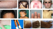 J Skin Stem Cell