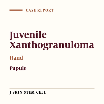 Juvenile Xanthogranuloma of the Hand: A Case Report
