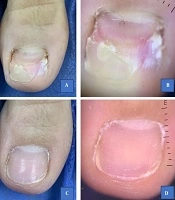 J Skin Stem Cell