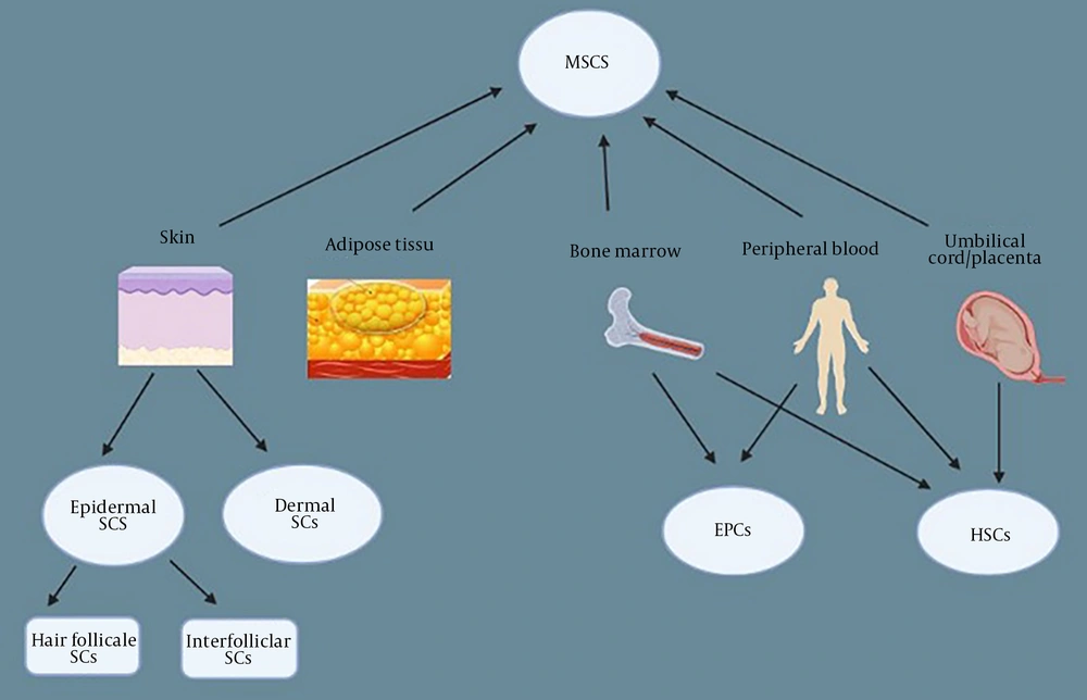 The major sources of stem cells that are pivotal in the procedure of wound healing. (Abbreviations: SCs, stem cells; HSCs, hematopoietic stem cells; MSCs, mesenchymal stem cells; EPCs, endothelial progenitor cells). The major sources of stem cells that are pivotal in the procedure of wound healing. (Abbreviations: SCs, stem cells; HSCs, hematopoietic stem cells; MSCs, mesenchymal stem cells; EPCs, endothelial progenitor cells).