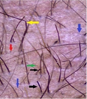 J Skin Stem Cell