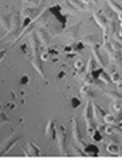 GO/TiO<sub>2</sub> Hybrid Nanoparticles as New Photosensitizers in Photodynamic Therapy of A375 Melanoma Cancer Cells
