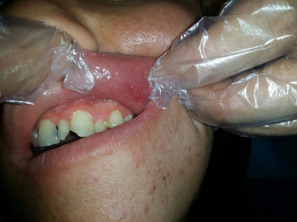 what does vit b12 injection do The Benefits Of Vitamin B12  Ugly London. Acupuncture & Chinese Herbal  Medicine