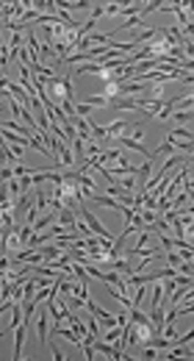 Dermal Fibroblast Cells: Biology and Function in Skin Regeneration